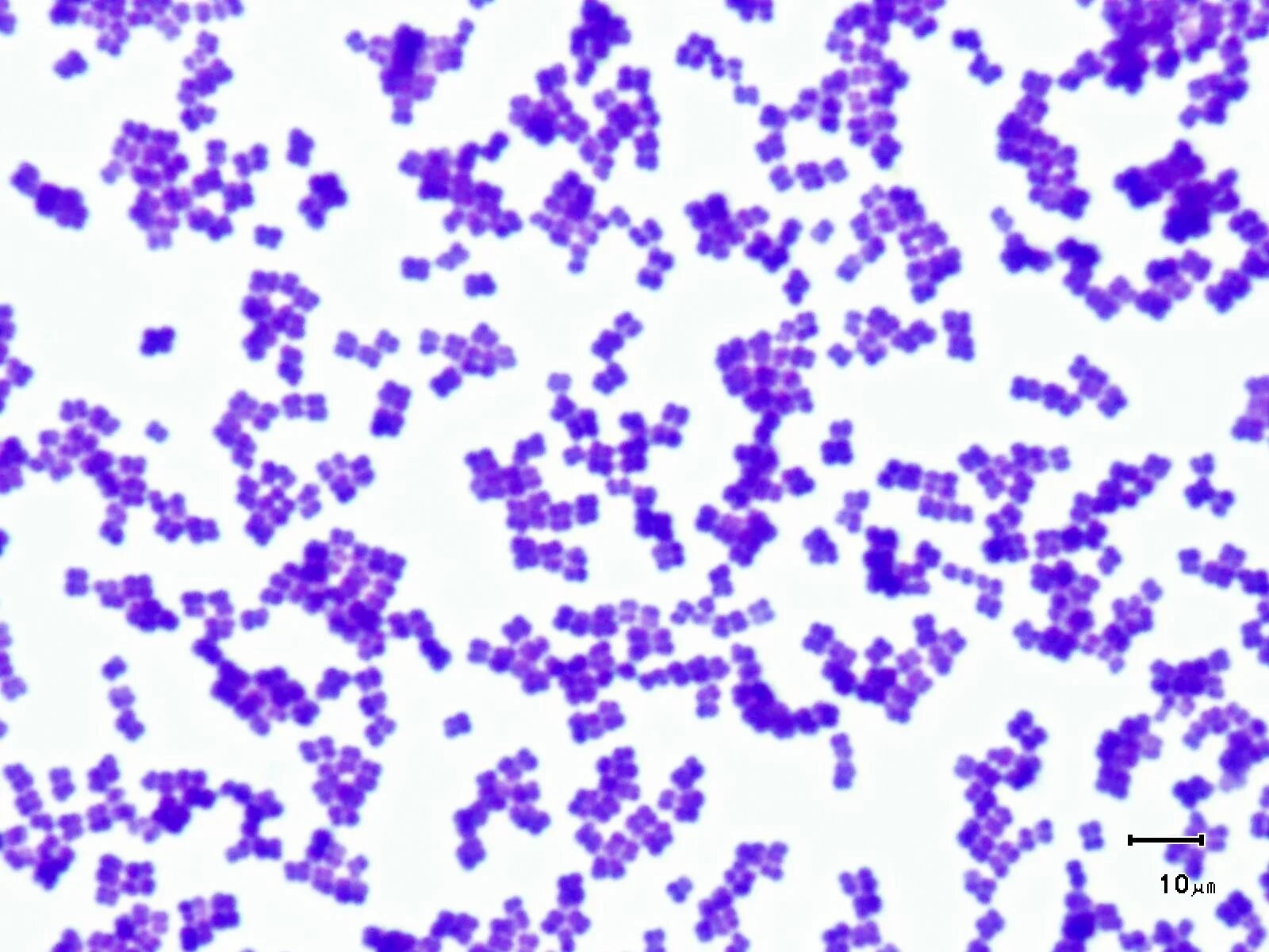 Сарцины стафилококки. Micrococcus luteus микроскоп. micrococcus luteus микробиология. грамположительные кокки. сарцины.. препарат micrococcus luteus.