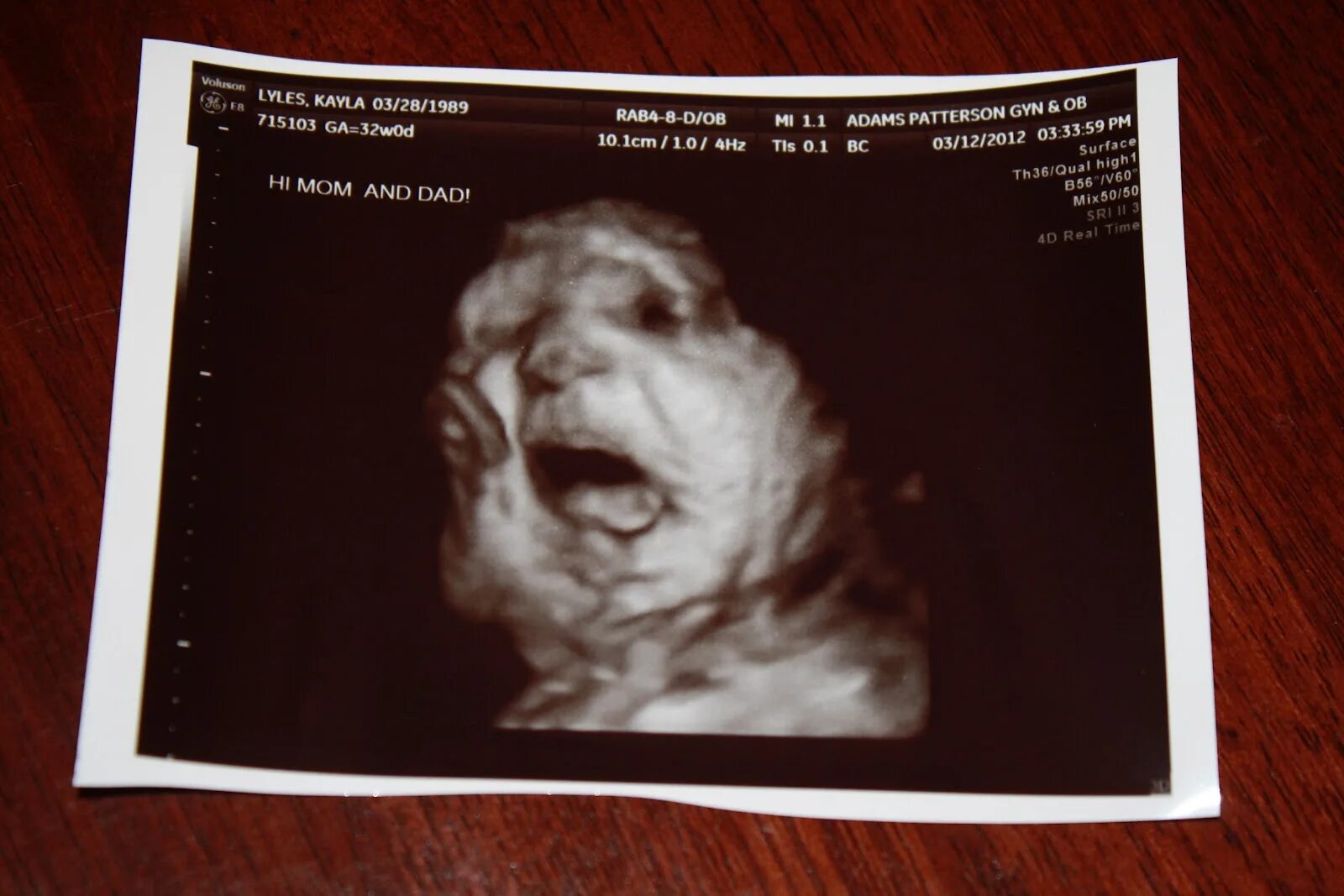 Вес ребёнка в 32 недели беременности. Узи плода 31 неделя беременности. Ребенок на 31-32 недели беременности. 3͓2͓н͓е͓д͓е͓л͓и͓ б͓е͓р͓е͓м͓. Рост и вес ребенка по неделям беременности таблица.