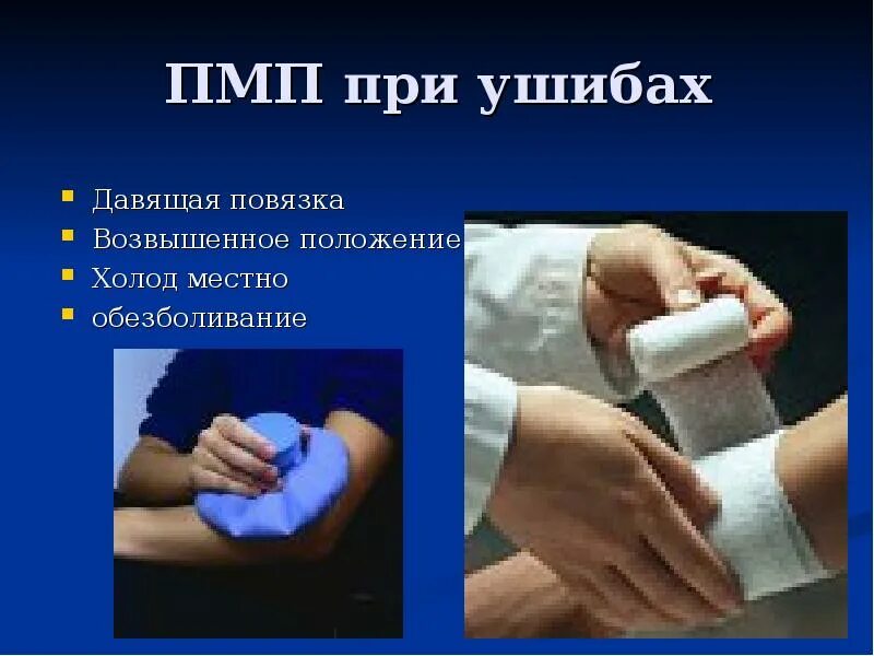 Первое помощь при ушибе. Давящая повязка при ушибе. оказание первой помощи при травмах и ушибах. пмп при ушибах. наложение давящей повязки при ушибе.
