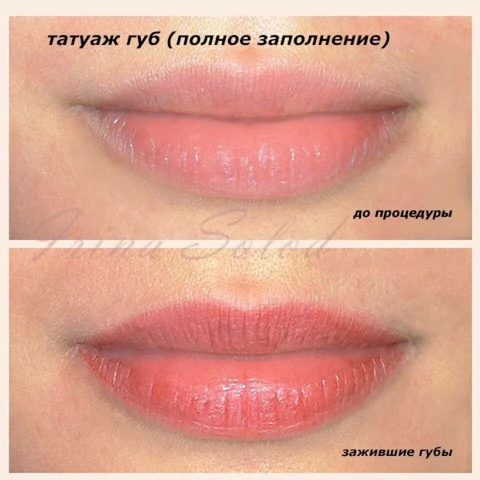 Татуаж губ через сколько. Пм губ заживление по дням. как заживает пм губ по дням.