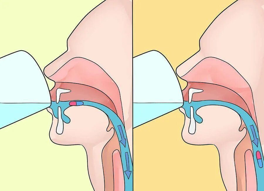 Воздух из гортани попадает в. Глотание рисунок. Сложно глотать таблетки. Глоточная фаза глотания.