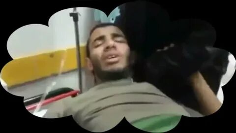 Человек в агонии перед смертью