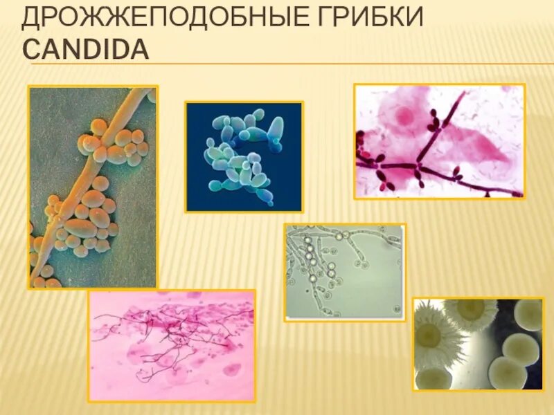 Дрожжеподобные грибы рода candida. Дрожжеподобными грибками рода candida. Дрожжи кандида. Кандида плесневые грибы. Формы кандидозной инфекции.