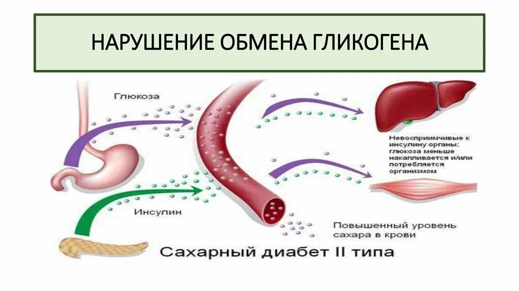 Превращение в печени гликогена в глюкозу. Нарушение обмена гликогена. Нарушение метаболизма гликогена. Патологии обмена гликогена. Нарушение обмена гликогена дистрофия.