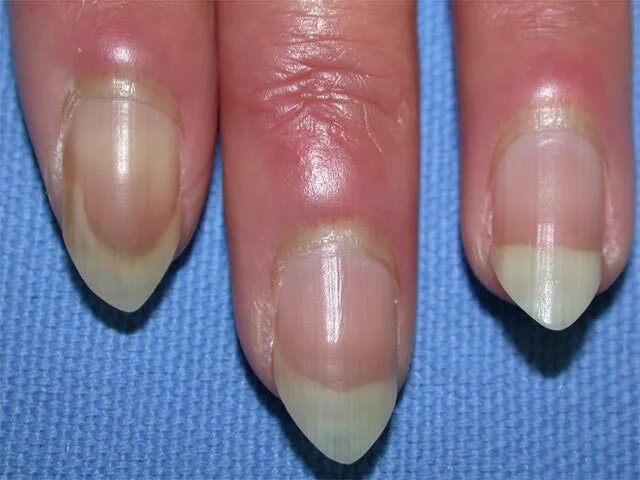 Средство для удаления кутикулы Триумф красоты Натуральный удалитель кутикулы с м