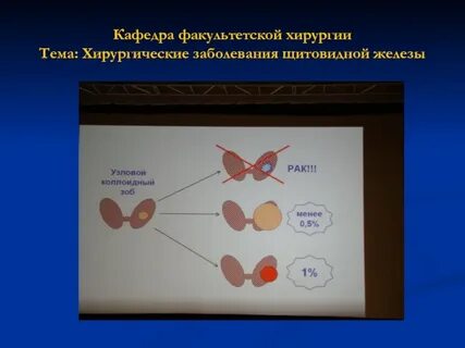 Щитовидная железа хирургическое вмешательство