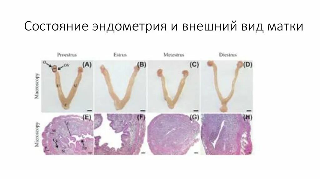 Тип матки человека. Тип матки человека