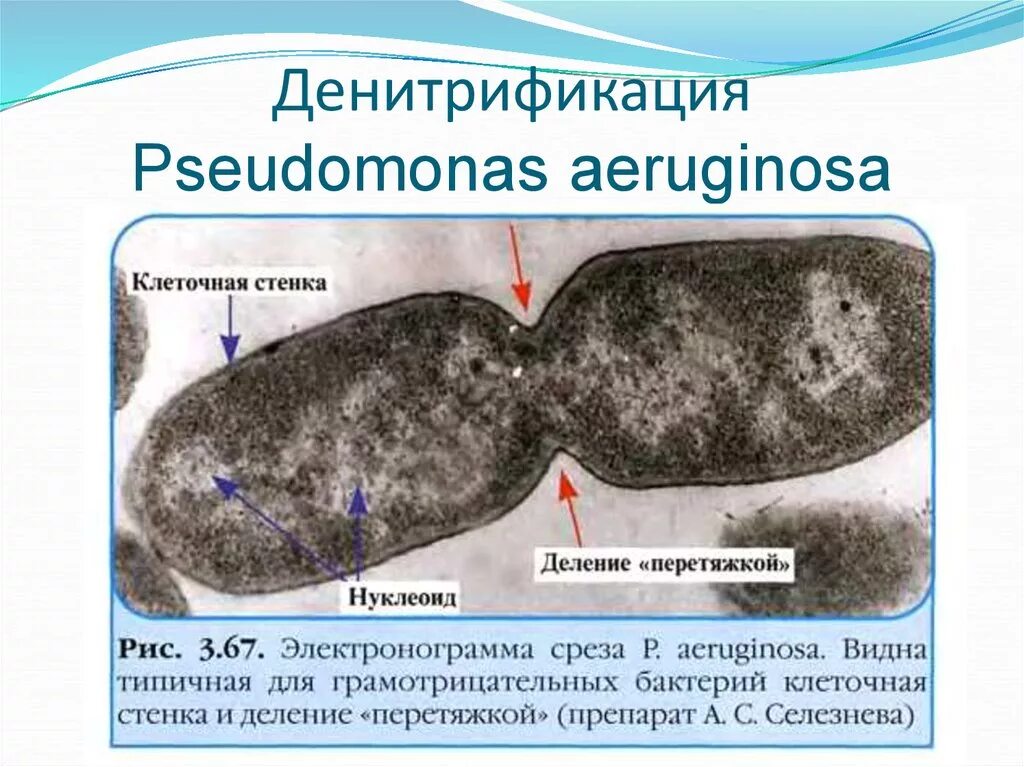 Денитрификация это. Денитрификаторы микроорганизмы. Денитрификация бактериями. Денитрифицирующие микробы. Денитрифицирующие бактерии способны.