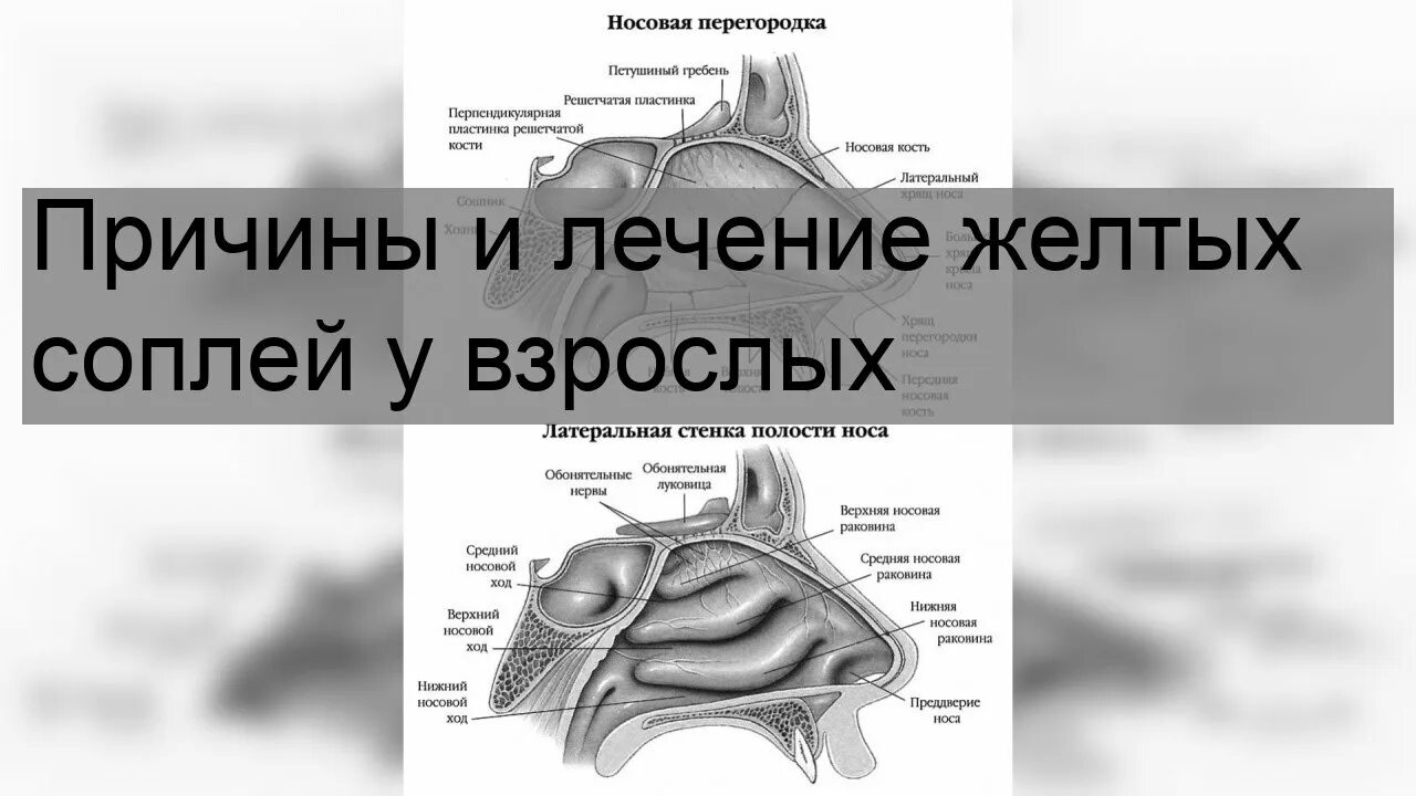 Причина желтых соплей у взрослого. Почему желтые сопли у взрослого