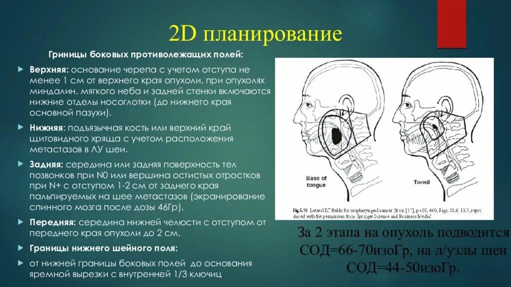 Температура после лучевой. Планирование лучевой терапии. 2д планирование в лучевой терапии. Планирование лучевой терапии презентация. Этапы планирования лучевой терапии.