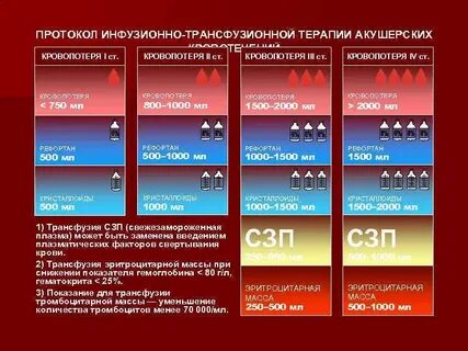 1500 потери