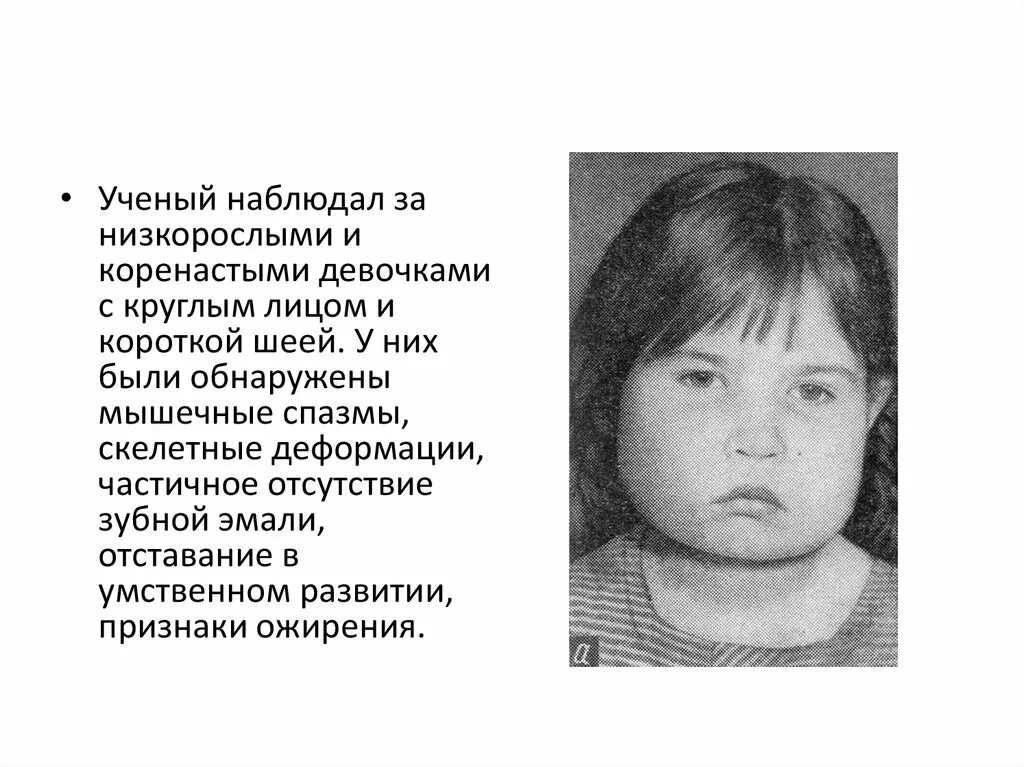 Синдром олбрайта. Маккьюна-олбрайта-брайцева. болезнь синдром олбрайта. олбрайта синдром презентация.