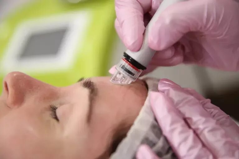 Дермотония. Щадящая процедура. Фонофорез в косметологии. Asclepion dermablate. Щадящая процедура.