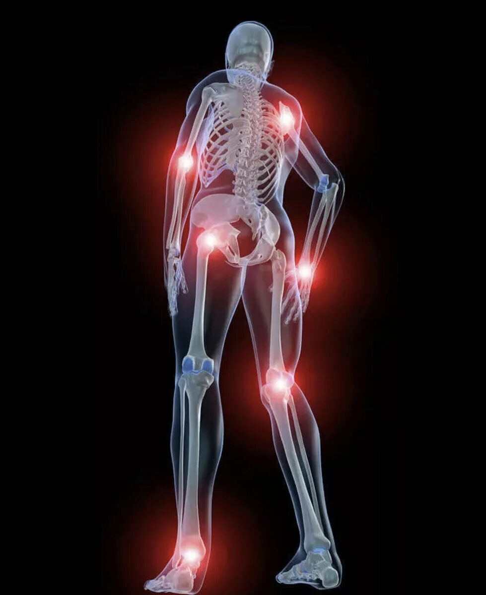 Здоровые суставы. Опорно двигательный аппарат. Заболевание суставов человека. Опопорно двигательный аппарат. Заболевание суставов человека.