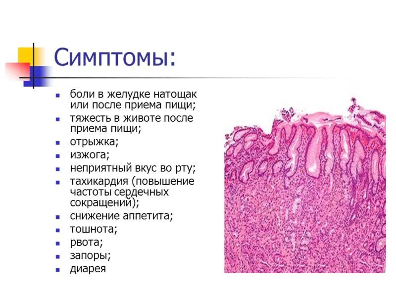 Боли в желудке после