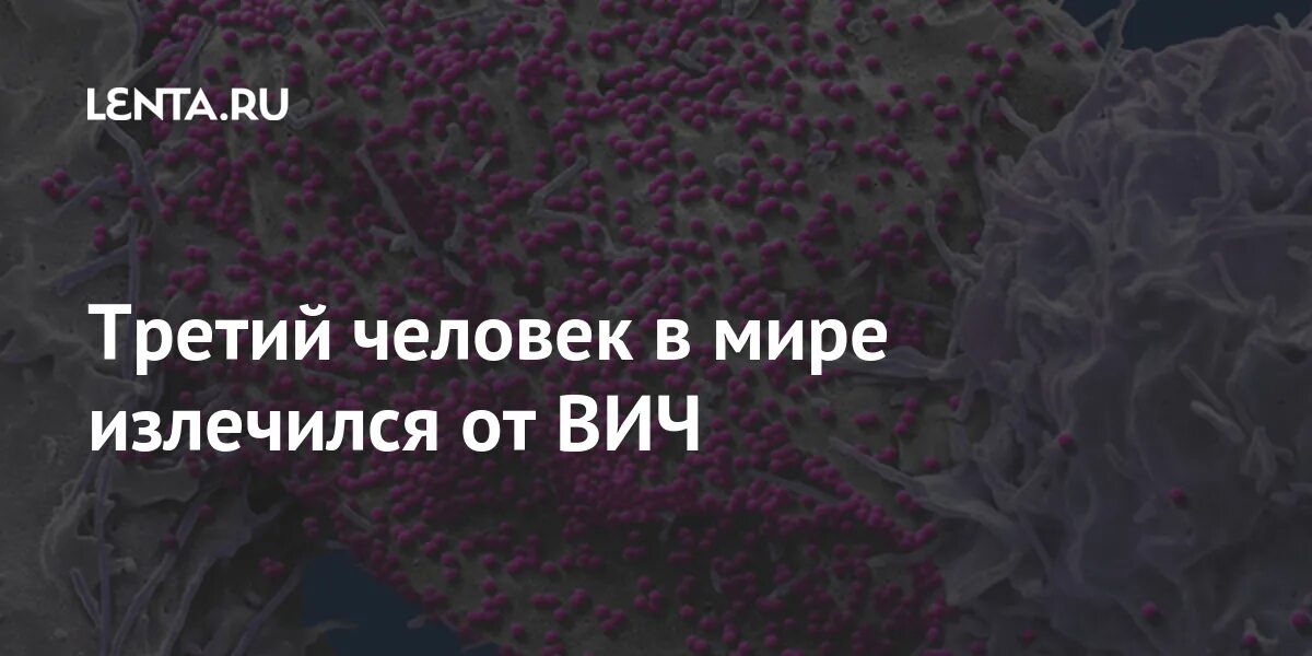 ВИЧ полное излечение последние новости. ВИЧ полное излечение. Третий человек излечился от ВИЧ. ВИЧ полное излечение на сегодня последние новости. Вич излечение прогноз