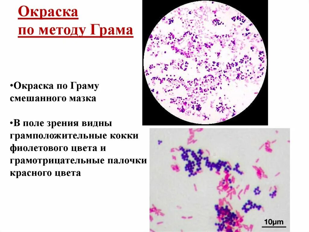 Микрофлора смешанная палочки. Грамположительные кокки микроскопия. Грамотрицательные кокки микробиология мазок. Грамположительные кокки окраска по Граму. Грамположительные кокки и палочки.