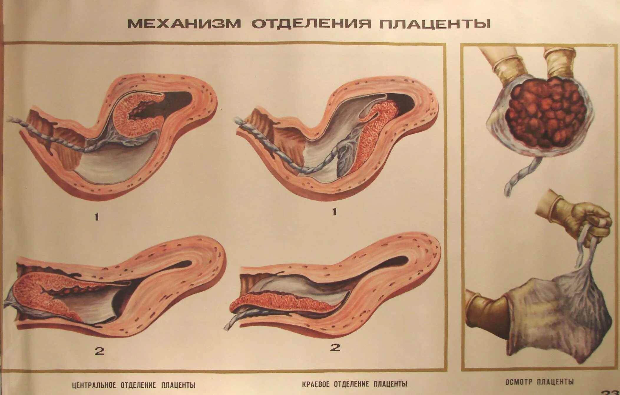 Выделения после осмотра гинеколога