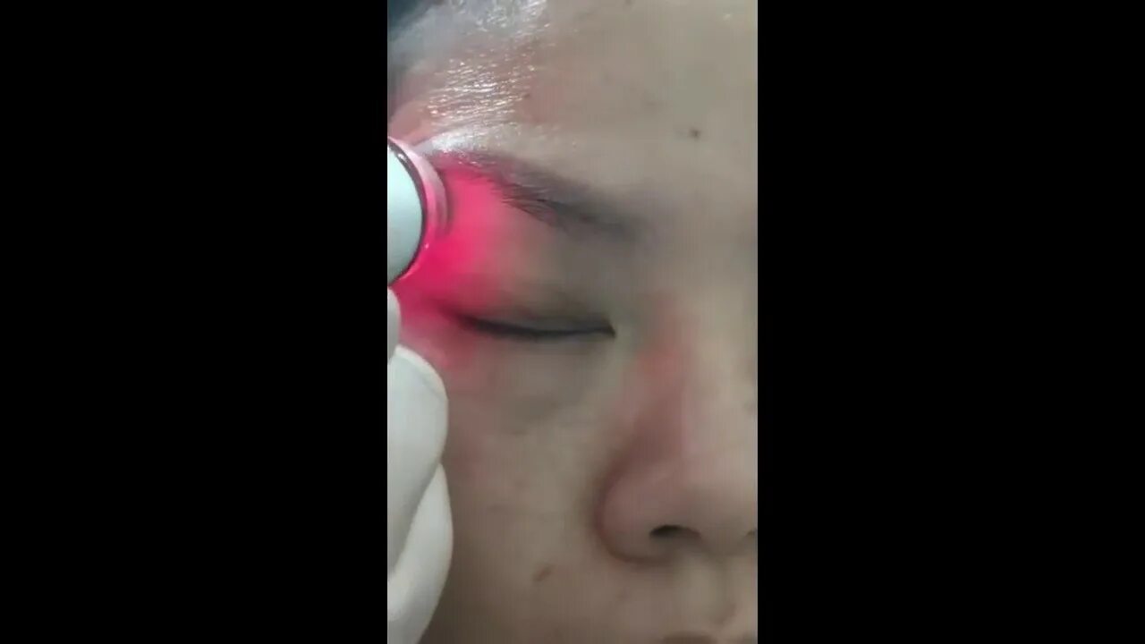 Ионный массажер для лица fohow. Ионный массажер fohow. Бьюти девайс ионный массажер. Fohow cc массажер для глаза. Бьюти девайс ионный массажер.