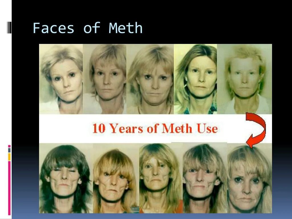 Курящие до и после. Женщина до и после курения. Внешность до и после курения. Влияние сигарет на внешность человека.