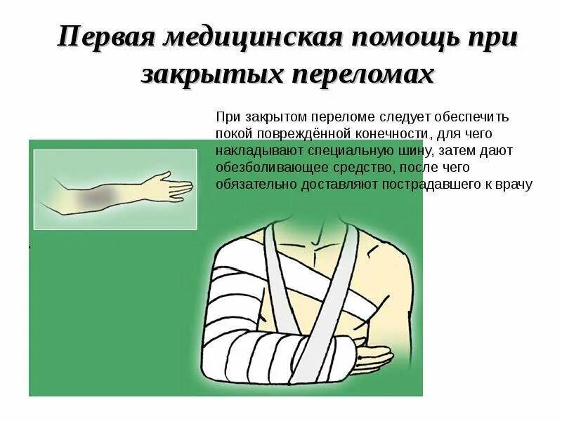 Первая помощь при переломах вывихах и растяжениях. Первая медицинская помощь при переломах. первая помощь при закрытых переломах. пмп при переломах, травмах. оказание первой помощи при вывихах.