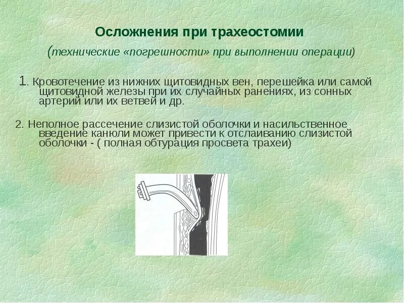 При выполнении операции произошла
