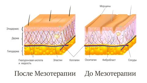 Кожу и делают ее эластичней