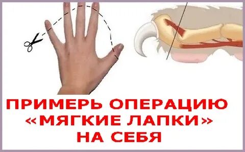Операция мягкие