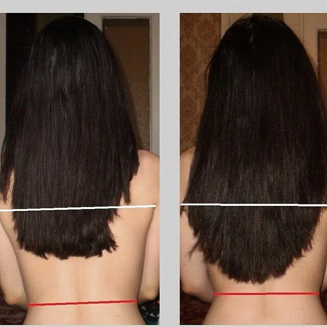 волосы отрасли за год. сколько волос на голове у человека. для роста волос. как быстро растут волосы на голове. почему не растут волосы на голове у женщин.