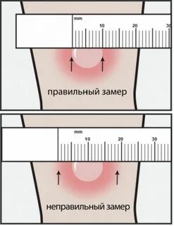 Сколько раз в году ставят манту