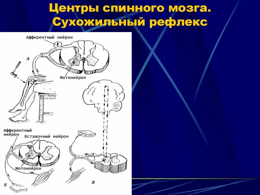 Центры рефлексов спинного мозга. Сухожильные рефлексы спинного мозга. Рефлексы спинного мозга сухожильные рефлексы. Классификация спинальных рефлексов.