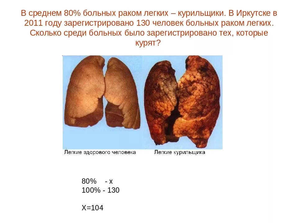 Какие легкие в норме