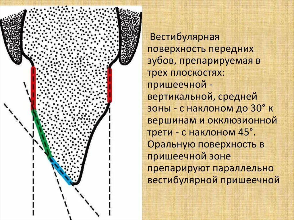 Вестибулярная поверхность зуба. Плоскости поверхностей зуба. Апроксимальных поверхностей зубов. Фронтальная плоскость зуба.