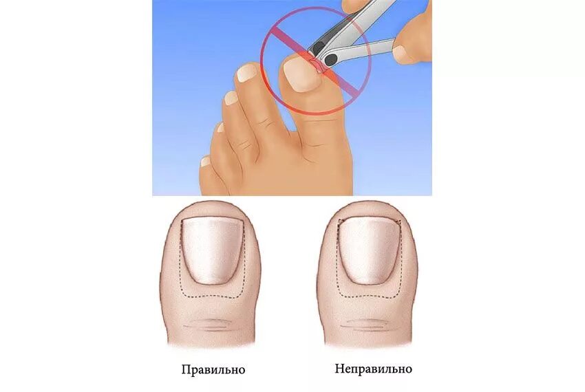 Титановая нить для ногтей