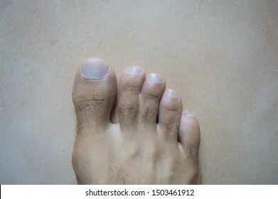 Webbed foot