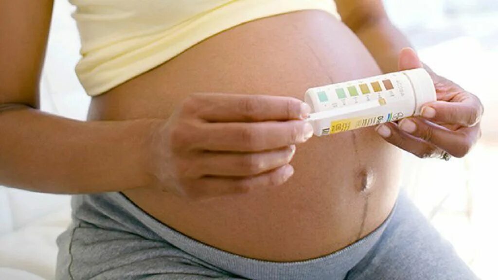 У женщин на ранних сроках. Моча при беременности. Моча беременных женщин. Моча у беременных на ранних. Цвет мочи беременной на ранних сроках.