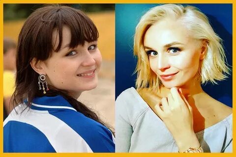 Гагарина до и после пластики