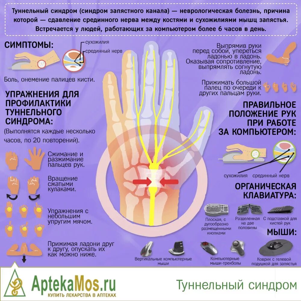 Болезнь кисти руки туннельный синдром. Двусторонний карпальный туннельный синдром кисти. Тунельныйсиндром запястья. Кистевой туннельный синдр.