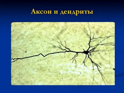 Аксоны нейронов образуют серое