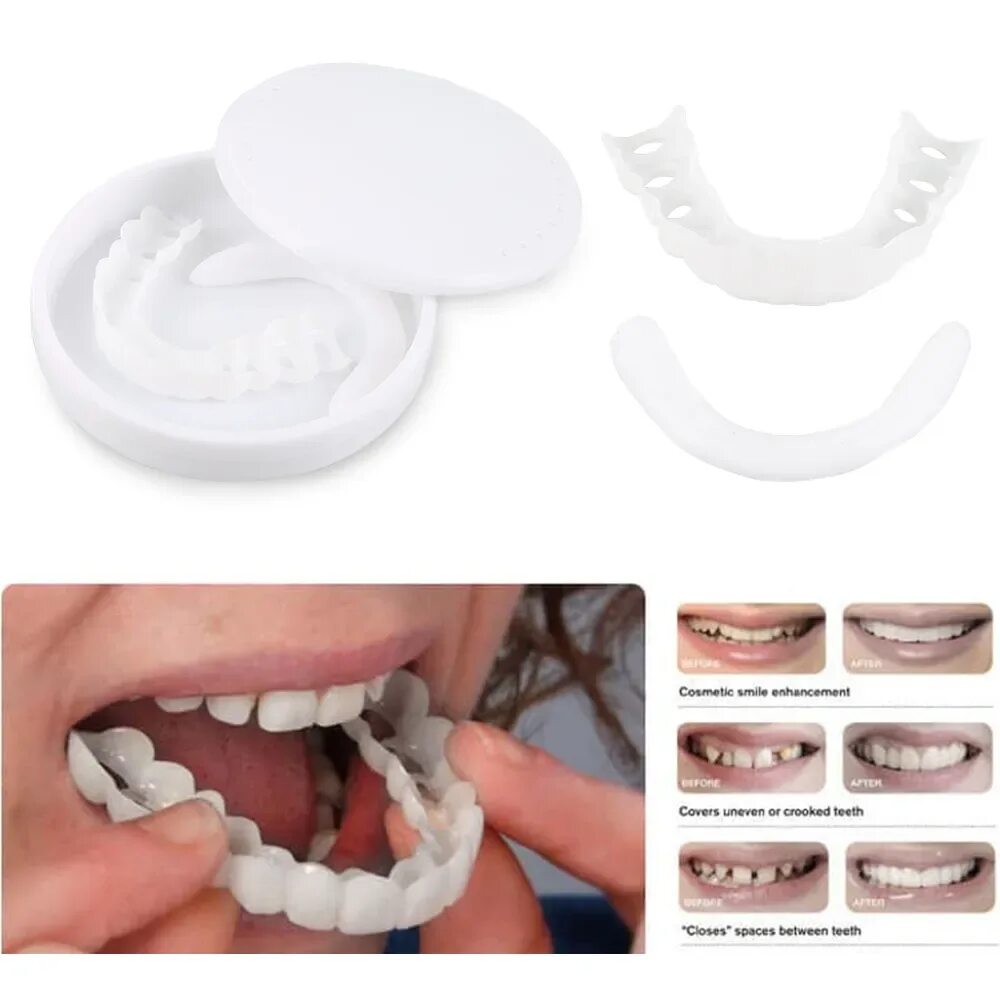 продаются виниры в аптеках. перфект смайл виниры. Mr smile виниры универсальные. виниры для зубов готовые. виниры для зубов snapon smile.
