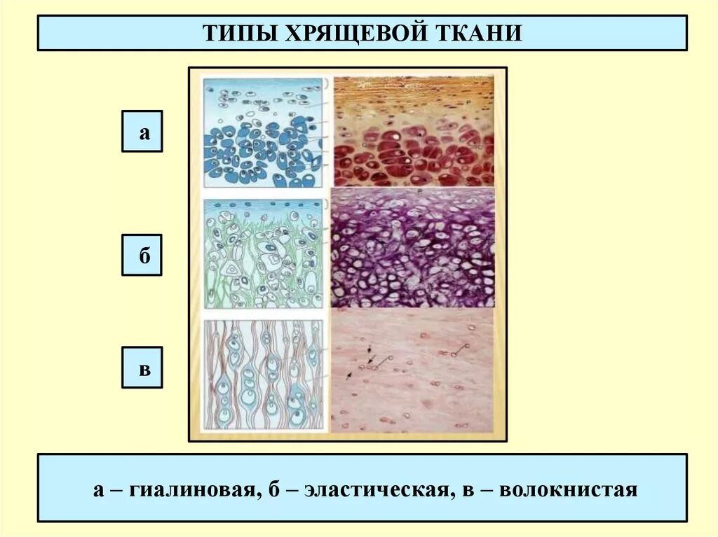 Хрящевая ткань является разновидностью. Типы хрящевой ткани. тип соединительной хрящевой ткани. хрящевая ткань ткань. тип хрящевой ткани человека.