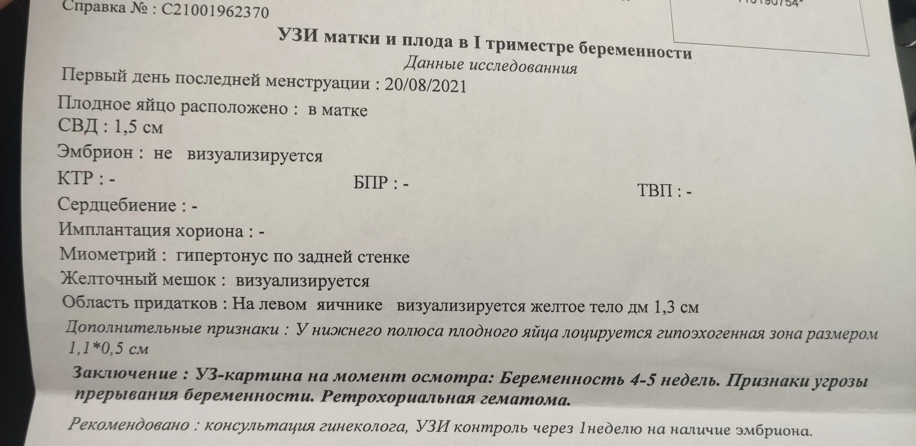 5 недель отзывы. Ретрохориальная гематома УЗИ заключение. УЗИ В 5-6 недель беременности гематома. УЗИ беременность 6 недель с гематомой. Гематома на УЗИ В 8 недель беременности.