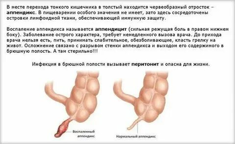 Удаление аппендицита когда можно пить