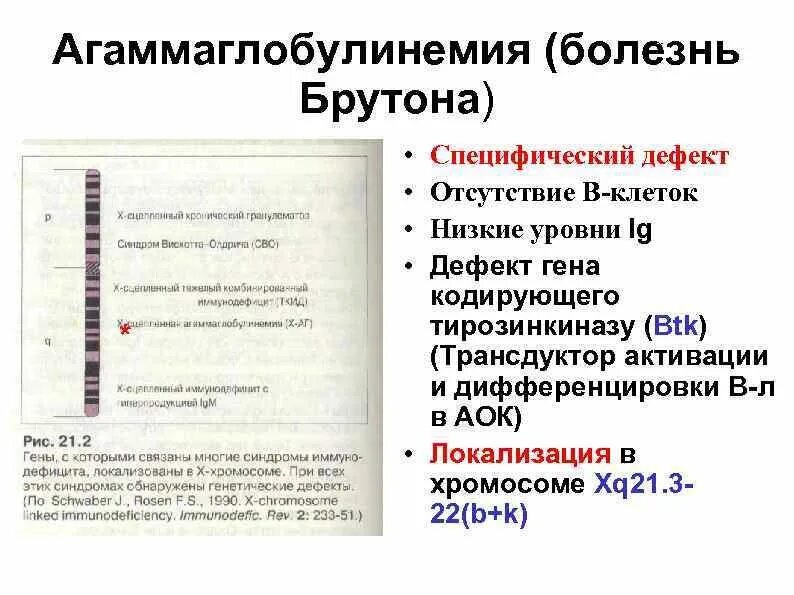 Иммунодефицит брутона. Агаммаглобулинемия Брутона. Агаммаглобулинемия болезнь Брутона. Болезнь Брутона иммунограмма. Болезнь Брутона специфический дефект.