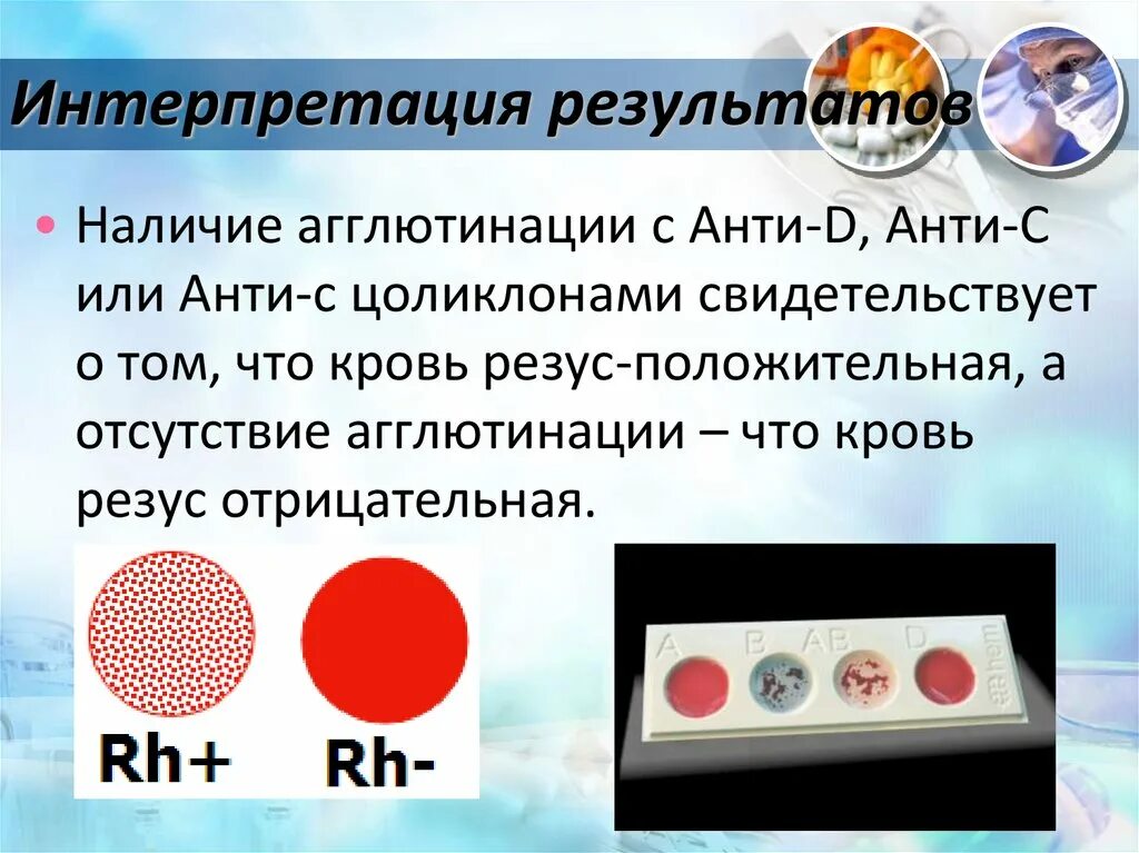 Группа крови Цоликлоны резус фактор. Реакция агглютинации для определения резус фактора. Методика определения резус-фактора цоликлоном анти-d. Набор для определения группы крови и резус фактора по цоликлонам.