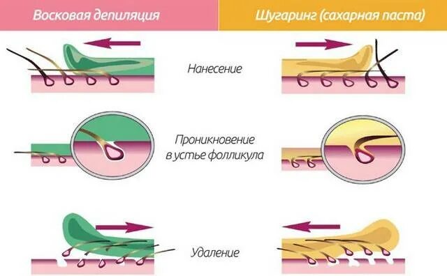 Через какое время после нанесения. Схема нанесения воска. восковая депиляция схема. схема удаления волос. схема нанесения шугаринга.