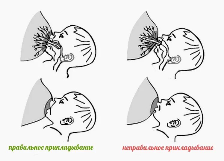 Правильное прикладывание малыша при грудном вскармливании. Как правильно прикладывать новорожденного к грудному вскармливанию. Правильное прикладывание малыша при грудном кормлении. Правильный захват при грудном вскармливании новорожденного.