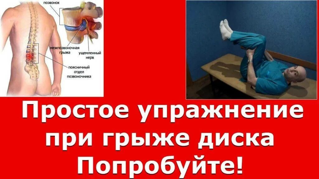 Какие уколы делают при поясничной грыже. Упражнения от грыжи в позвоночнике. упражнения для спины от грыжи. упражнения при межпозвонковой грыже позвоночника. упражнения для поясницы при болях.