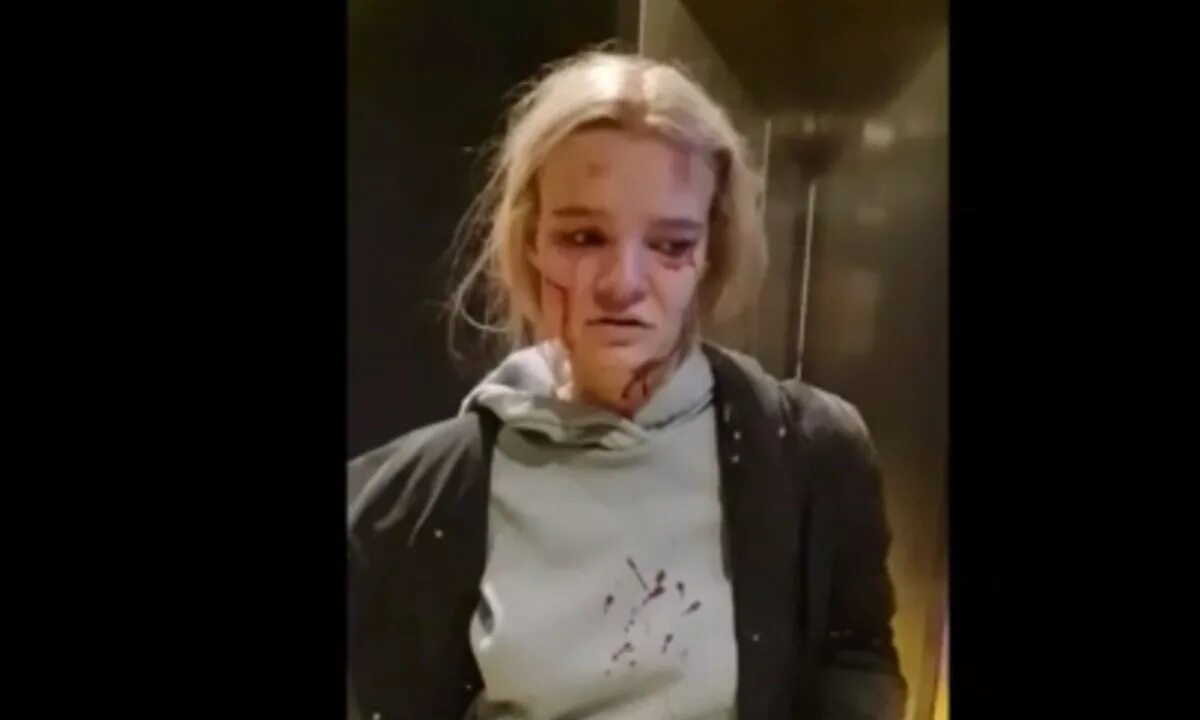 Девушка разбилась песня. Девочка разбилась в лифте.