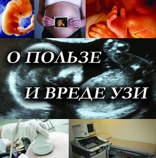 Узи вредно при беременности